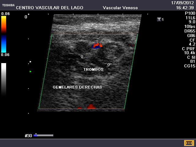 eco-doppler-centro-vascular